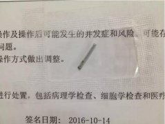 年底装修赶工 一月连发三例铁钉伤眼事故