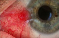 国庆长假，这时不切胬肉更待何时？