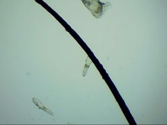 眼睛发痒是结膜炎的锅,还是螨虫之过?