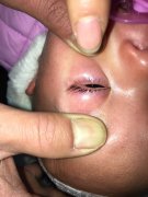 【重口！】在眼睛上与我们共生的生物