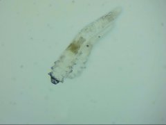 你的生活质量，由你眼睛上的螨虫决定