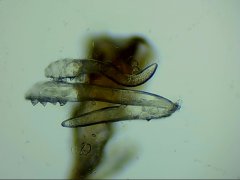 滚滚得了螨虫眼?螨虫真的会引起脱毛吗