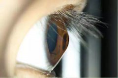 视力突然下降？又要换眼镜？这是孩子的