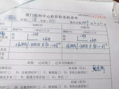 散光750度以上，还能做近视激光手术吗？