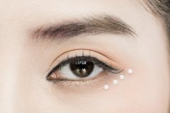 眼睛为什么那么多红血丝?