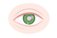 白内障人工晶体能否更换？何时换？