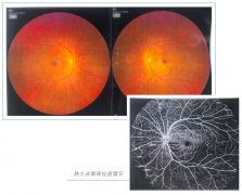超8小时“眼中风”险失明！厦门眼科中心