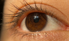 青光眼只有老人会得？