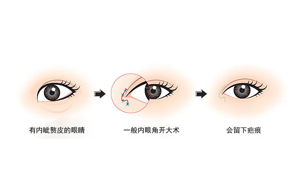 阴形眼睛适合什么人,阴形眼睛适合什么人戴