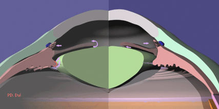 眼压高最易患青光眼,当心失明危险!