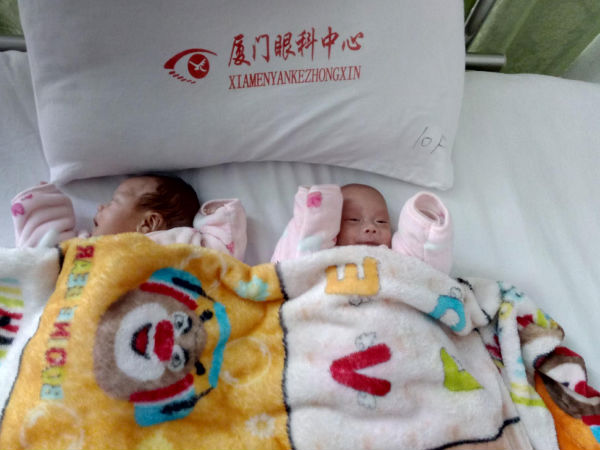 双胞胎早产儿视网膜病变