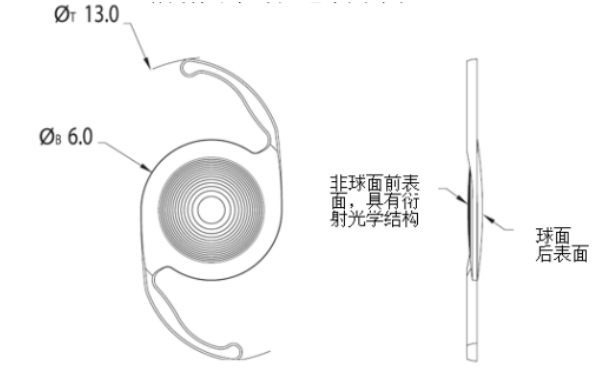 爱尔康三焦点