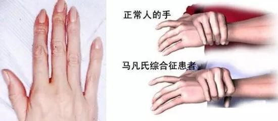 厦门眼科中心