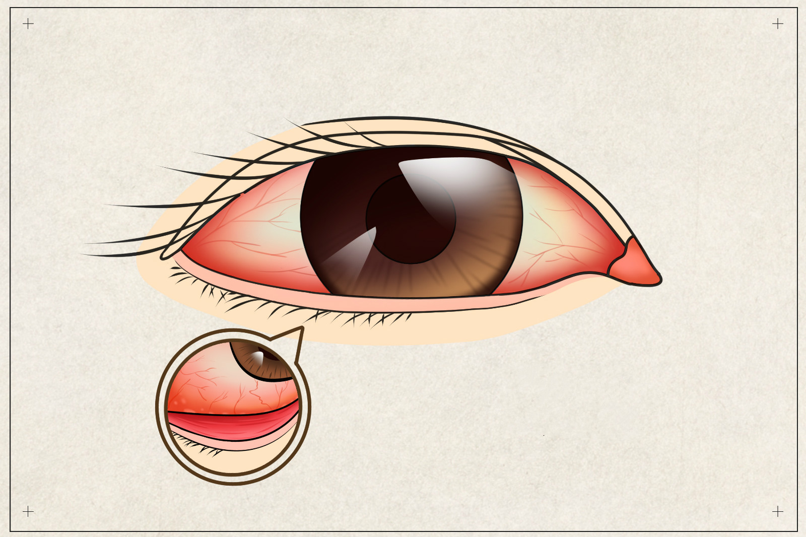 眼角红肿疼是怎么回事,内眼角红肿 - 伤感说说吧