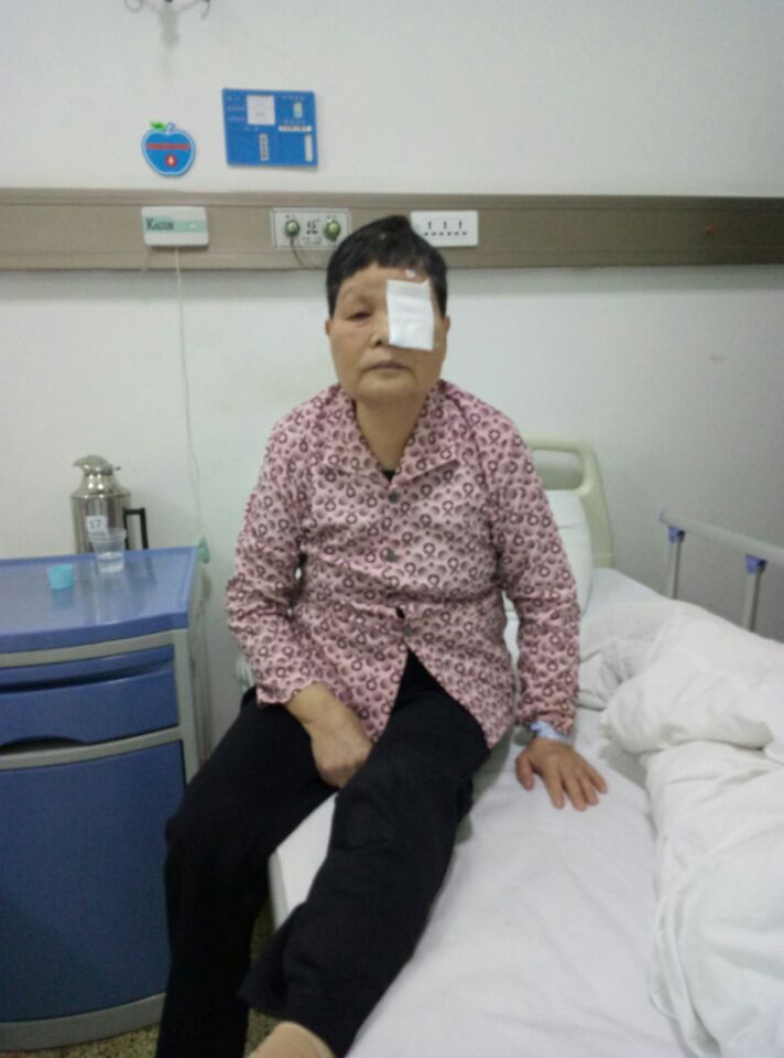 聋哑人白内障手术
