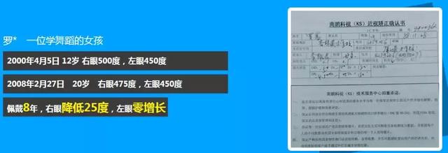 角膜塑形镜
