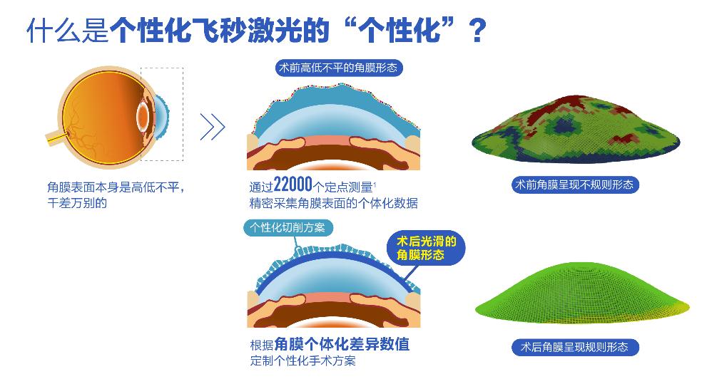 个性化微飞秒