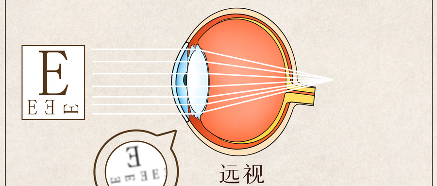 老花眼症状