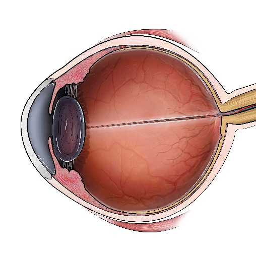 视网膜脱落类型