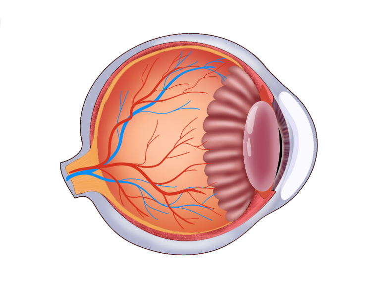 视网膜脱离症状