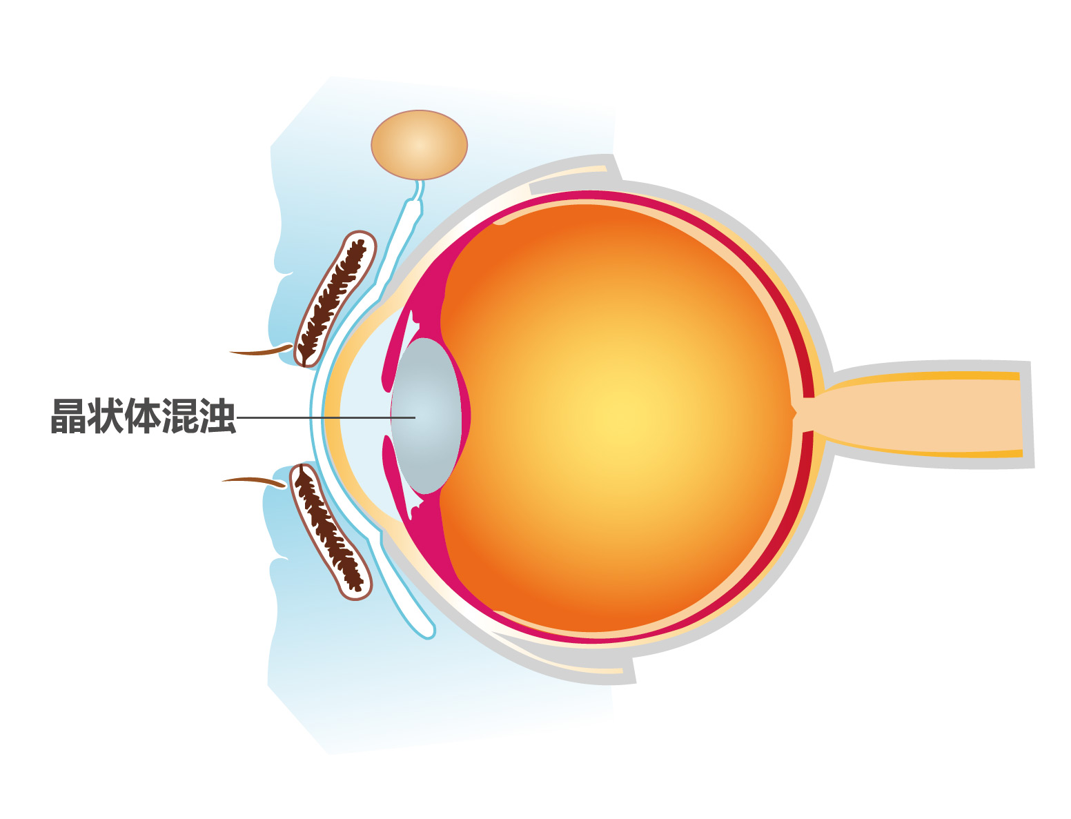 老花眼症状