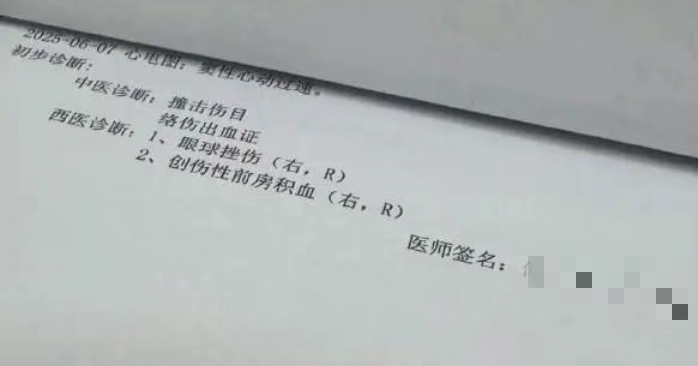 眼外伤