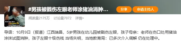 眼外伤