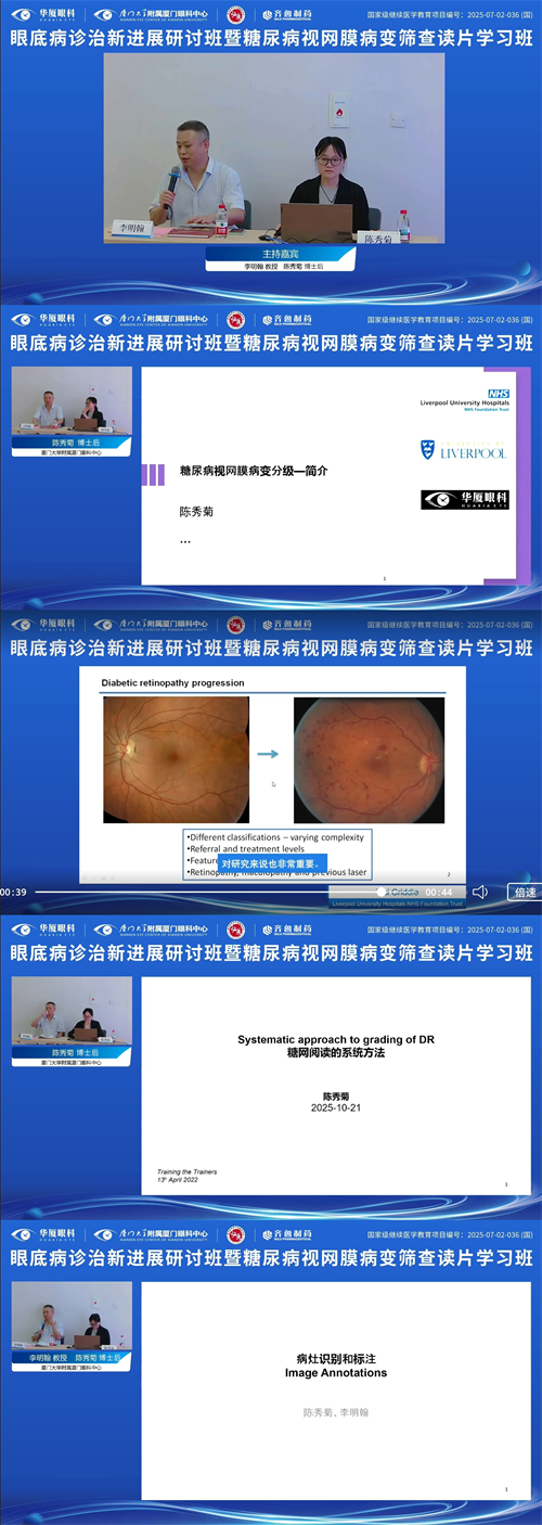 眼底诊治新进展