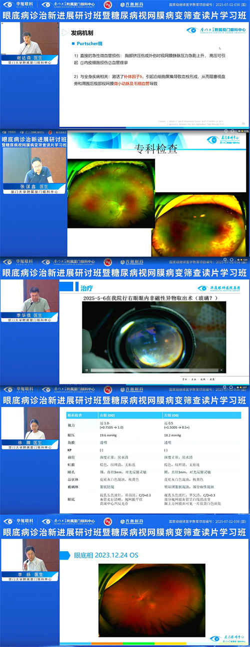 眼底诊治新进展研讨班