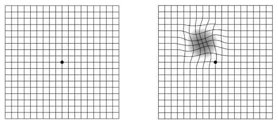 阿姆斯勒方格表